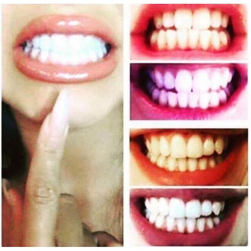 Whitening toothpaste